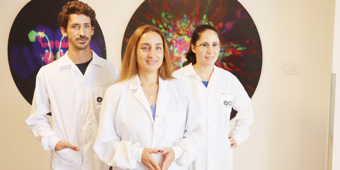 Hirntumor aus dem 3D-Drucker | Jüdische Allgemeine - Vimarsana News