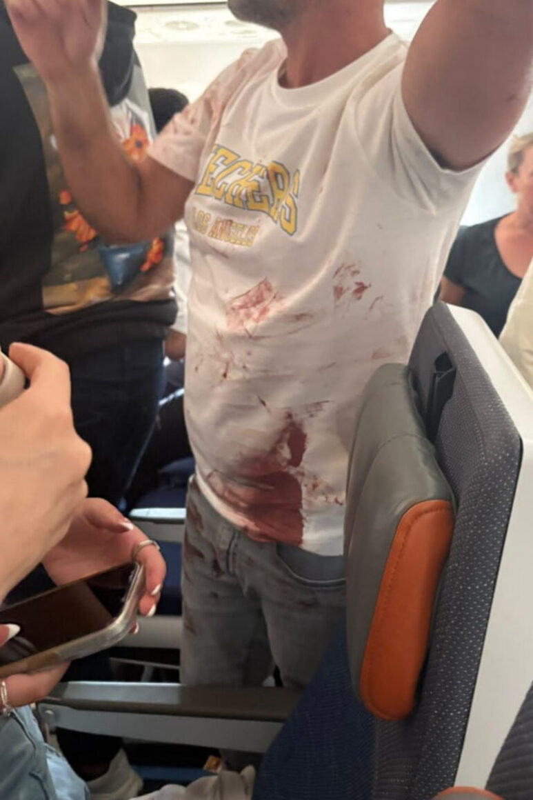 Ein unverletzter Passagier des FylDubay-Fluges, dessen Shirt aber blutbefleckt ist